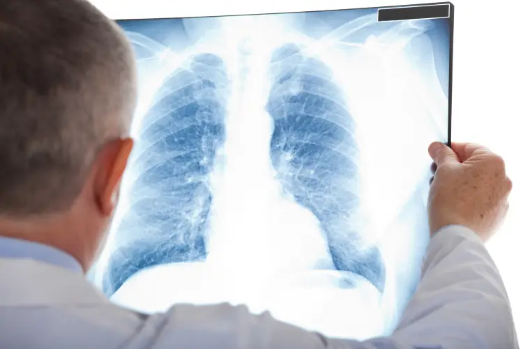 Doctor Reviewing Lung X Ray Of Swimmer Near Drowning