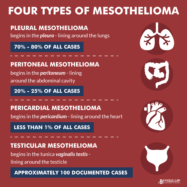 Mesothelioma Types Infographic