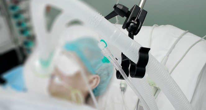 Patient In ICU On Ventilator