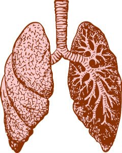 lungs that have been damaged by asbestos exposure
