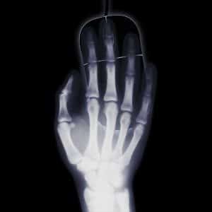 x-ray-of-a-woman-who-filed-a-medical-malpractice-lawsuit